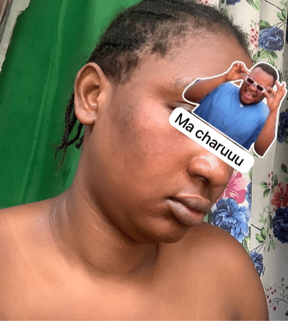 Savon anti - taches au curcuma | 100% Naturel (GN)