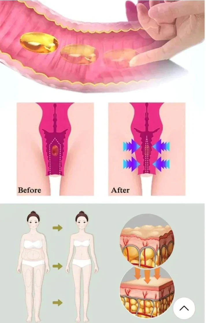 Gélules BioNaturelles de réparation vaginale GN