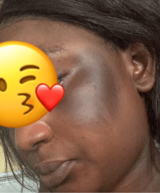 Savon anti - taches au curcuma | 100% Naturel (GN)