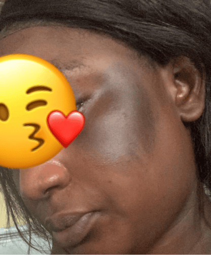 Savon anti - taches au curcuma | 100% Naturel (GN)