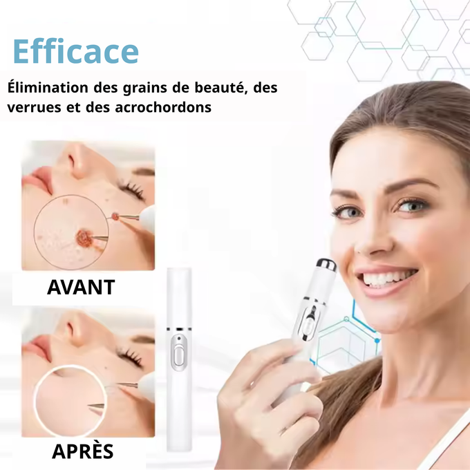 Stylo Laser ProMax – Grains & Verrues KO! GN