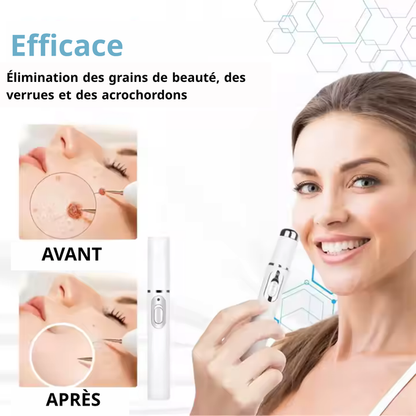 Stylo Laser ProMax – Grains & Verrues KO! GN