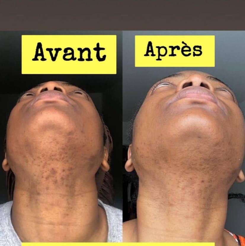 Savon anti - taches au curcuma | 100% Naturel (GN)