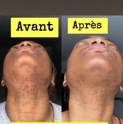 Savon anti - taches au curcuma | 100% Naturel (GN)