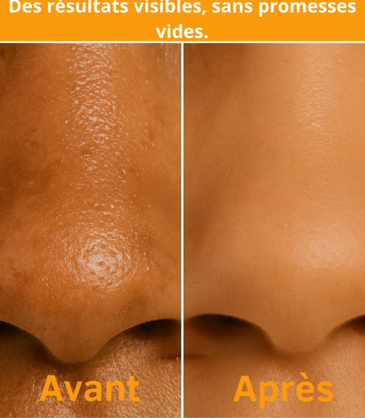 Patchs Nez Purifiants(10 Patchs)