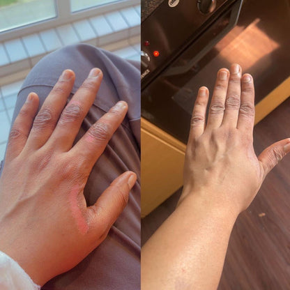 Savon anti - taches au curcuma | 100% Naturel (GN)