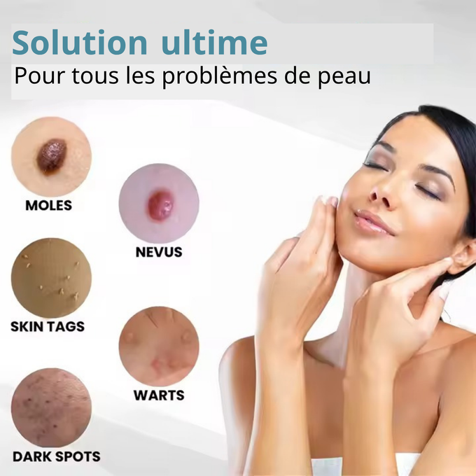 Stylo Laser ProMax – Grains & Verrues KO! GN